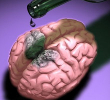 Как работает мозг. Мозг и алкоголь [ВИДЕО]