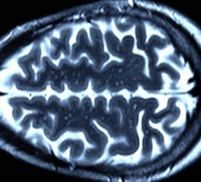 Учёные скрыли смерть пациента с «оживленным» мозгом