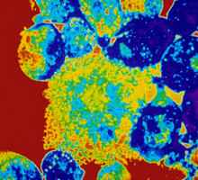 Биологи обнаружили гигантские бронированные вирусы